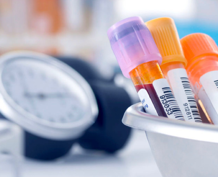 blood test