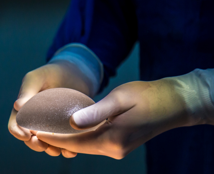 Breast implant rupture section