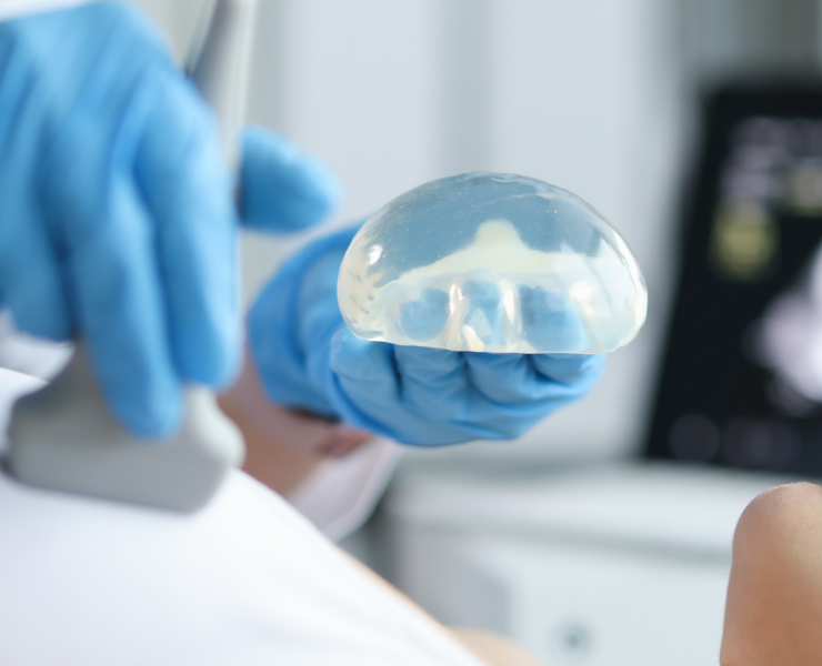 implant scan